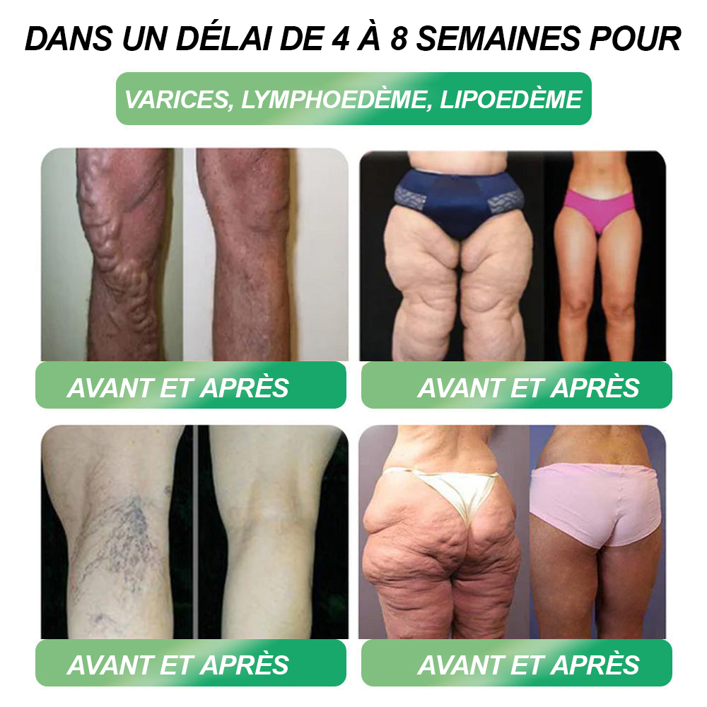 HHVB® Il ne reste plus que 10 boîtes ! Nous vous offrons 30% de réduction supplémentaire ! 4-5 boîtes vous permettront de retrouver la forme ! Si vous ratez cette offre, il faudra attendre l'année prochaine !